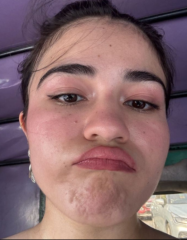 Anu